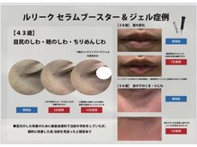 マーラアンジュプラス/