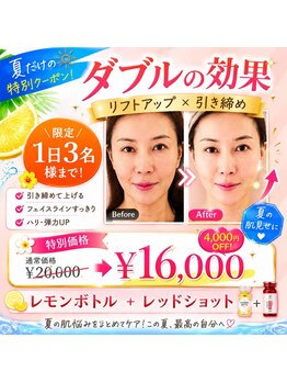 アン 銀座(ann)/レモン&レッド　wの効果