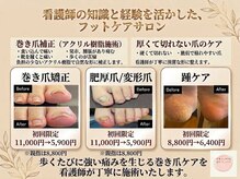 フッティーナ ナースプラス(フッティーナNs+)