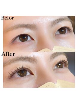 プリュスマイル(+Smile.)/アップワードリフト