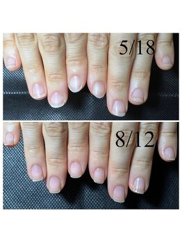 アマランサス(Amaranthus)/最強のネイルケアコース