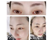 アーチ 代々木上原(ARCH)/光フェイシャルと眉パとまつパ