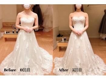 ルフレ(REFLET)/【事例13】Before/After痩身