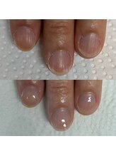 ウェルズユキ(well's yuki)/10代から70代まで通う自爪育成