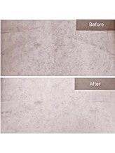 ビビ(VIVI)/ハーブピーリング背中ケア