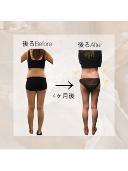 ユメカ 日の出院(YUMEKA)/産後のお客様。4ヶ月後★後ろ