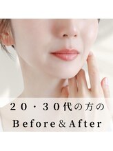 アロハ(ALOHA.)/２０-３０代の方のBefore＆After