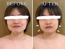 ヨサパーク ニコナ 三軒茶屋南口(YOSA PARK nicona)/滝汗！むくみすっきり！痩身