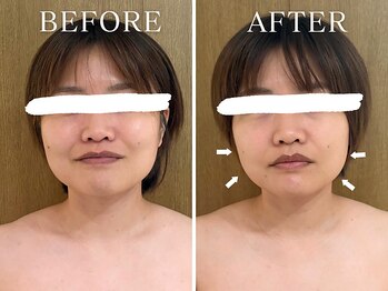 ヨサパーク ニコナ 三軒茶屋南口(YOSA PARK nicona)/滝汗！むくみすっきり！痩身