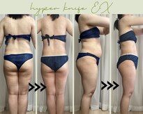 リヘッド(Re.head)