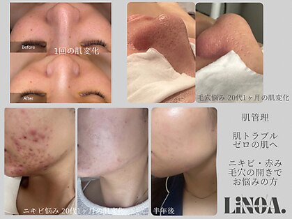 リノアドット(LiNOA.)の写真
