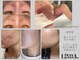 リノアドット(LiNOA.)の写真