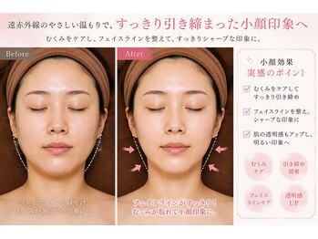 トータルヘルスビューティーカズ(TotalHealthBeauty KAZU)の写真/新感覚の温める美容でたるみ・むくみを改善しリフトアップ♪寝るだけの浴びる美容で楽して小顔&肌質改善☆