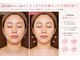 トータルヘルスビューティーカズ(TotalHealthBeauty KAZU)の写真/新感覚の温める美容でたるみ・むくみを改善しリフトアップ♪寝るだけの浴びる美容で楽して小顔&肌質改善☆