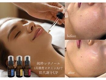 アトリア(ATRIA)の写真/くすみ知らずの水光肌で自信！素肌を育て艶肌を目指す土台作りでニキビ予防もサポートします◎