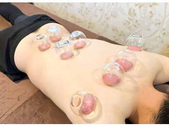 トータルボディサポート ハジメ/鍼灸治療