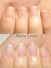 マリーロール 淀屋橋本店(Marie Laure)/自爪育成/深爪矯正/ネイルケア