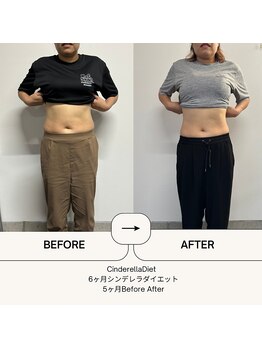 オーシャン整骨院(OCEAN整骨院)/6ヶ月コース