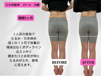 ビジリンヌ/ビフォーアフター1ヶ月