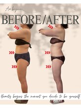 エイエービジュー(Aa.bijou)/