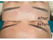 夏秋美肌サロン/毛穴洗浄+フェイシャルワックス