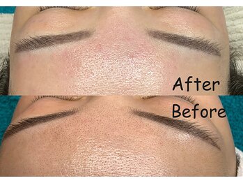 夏秋美肌サロン/毛穴洗浄+フェイシャルワックス