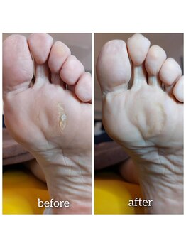 爪切り屋 足楽/