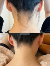 エリス(ELISSE)/学生がお得！学割うなじ脱毛