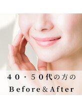 アロハ(ALOHA.)/４０-５０代の方のBefore＆After