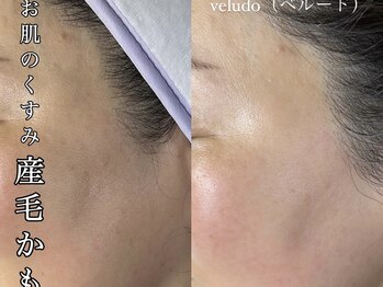 ベルード(veludo)/