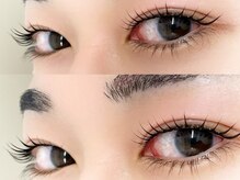 ソリン(Solin')