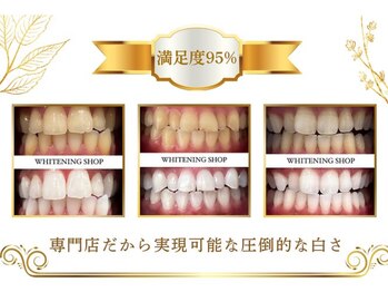 ホワイトニングショップ 北千住店