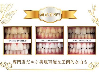 ホワイトニングショップ 北千住店の写真