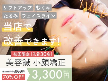 福岡博多美容鍼灸院ハリナチュレ【小顔矯正/美容鍼/リフトアップ/ララピール】の写真