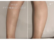 ベル 大和(Belle)/HI-UP｜ボディー痩身