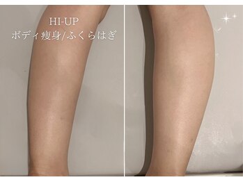 ベル 大和(Belle)/HI-UP|ボディー痩身
