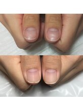 キュア(Cure.)/大人気!!自爪風ジェルネイル