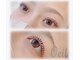 ヴェール(Veil)の写真/悩みを解消して目元美人に！まずはお気軽にご相談ください！