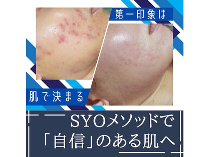 祥(SYO)の写真