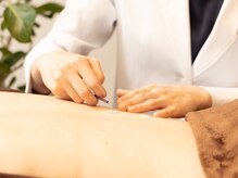 立川レディース鍼灸マッサージ はるはる/お灸は女性の味方です