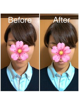 カイロプラクティック ネクサス/顔の歪み撃退☆