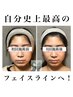 《再来の方》小顔頭蓋骨矯正＋リンパケア8回コース　￥61600→￥41600