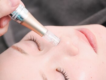 ドロップ 西宮(Drop)の写真/《毛穴ケア専門店》いちご鼻を高濃度水素水毛穴洗浄で【黒ずみ/角栓毛穴を改善！卵のようなうるツヤ肌に】