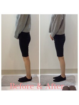 スタイルラボ高松/産後骨盤矯正の効果♪