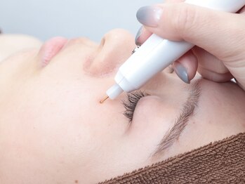 ビュー(Beau)の写真/【最新シミケア機器で諦めていたシミを改善】ホームケアや美容施術でも改善されなかったシミへアプローチ★