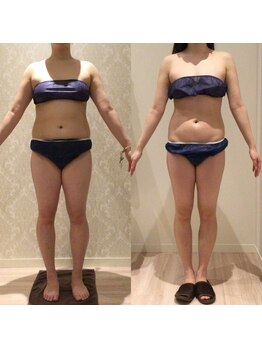 アユアランリンク 札幌店/20代後半/約7ヵ月/-9.1kg