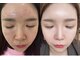 サロンドモモ(SALON de MOMO)の写真/くすみ・透明感が気になる方へ|美肌ケア