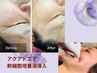 【Newオープン限定】幹細胞培養液導入ハリツヤ肌に☆60分　¥4,980