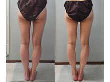 ルミルナ(Lumi Luna)/20代に人気★下半身痩せ！