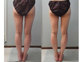 ルミルナ(Lumi Luna)/20代に人気★下半身痩せ！